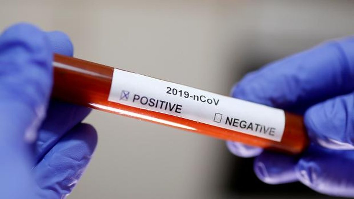 koronavirus-3.-jpg.v1