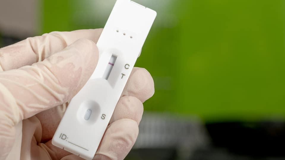 Koronavirus Testi per COVID-19